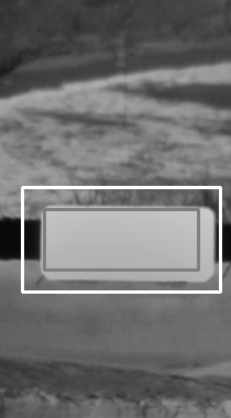 Typical candidate sprocket: homogeneous region (grey box), histogram region (white box)